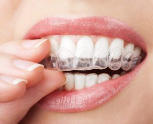 Dentística em Igarapé